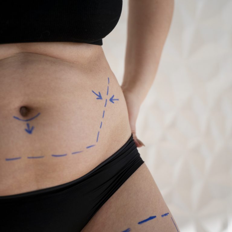 cuerpo-de-mujer-con-rastros-de-marcador-de-cerca